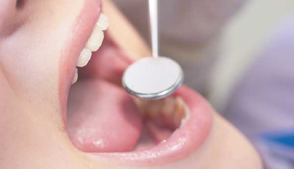 Infección de muelas - Clínica Dental Villaverde, Madrid